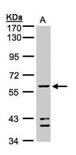 ALDH1B1 Antibody in Western Blot (WB)