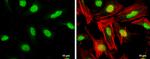 GTF2B Antibody in Immunocytochemistry (ICC/IF)