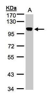 NCAPH Antibody in Western Blot (WB)