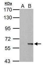 MST2 Antibody in Western Blot (WB)