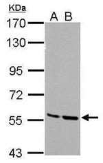 MST2 Antibody in Western Blot (WB)