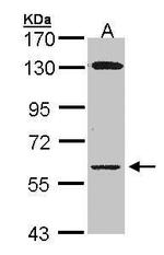 Glycerol kinase Antibody in Western Blot (WB)