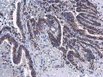 Adenylate Kinase 4 Antibody in Immunohistochemistry (Paraffin) (IHC (P))