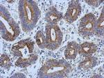 Adenylate Kinase 4 Antibody in Immunohistochemistry (Paraffin) (IHC (P))