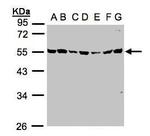 MST3 Antibody in Western Blot (WB)