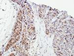 SPHK1 Antibody in Immunohistochemistry (Paraffin) (IHC (P))