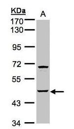 SPHK1 Antibody in Western Blot (WB)