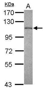 EXOSC10 Antibody in Western Blot (WB)