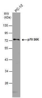 p70 S6 Kinase Antibody in Western Blot (WB)