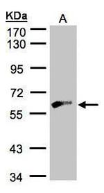 GK2 Antibody in Western Blot (WB)