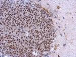 CK2 alpha-1 Antibody in Immunohistochemistry (Paraffin) (IHC (P))