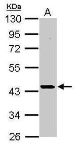 CK2 alpha-1 Antibody in Western Blot (WB)