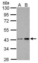 CK2 alpha-1 Antibody in Western Blot (WB)