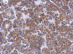 FN3K Antibody in Immunohistochemistry (Paraffin) (IHC (P))