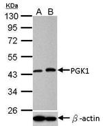 PGK1 Antibody in Western Blot (WB)