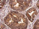 CrkL Antibody in Immunohistochemistry (Paraffin) (IHC (P))