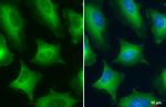 PKM2 Antibody in Immunocytochemistry (ICC/IF)