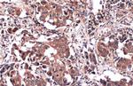 PKM2 Antibody in Immunohistochemistry (Paraffin) (IHC (P))