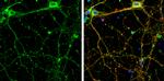 SHANK1 Antibody in Immunocytochemistry (ICC/IF)