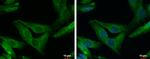 SHANK1 Antibody in Immunocytochemistry (ICC/IF)