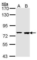 Rabenosyn 5 Antibody in Western Blot (WB)