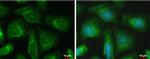 PFKFB4 Antibody in Immunocytochemistry (ICC/IF)