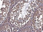 PFKFB4 Antibody in Immunohistochemistry (Paraffin) (IHC (P))