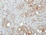 PFKFB4 Antibody in Immunohistochemistry (Paraffin) (IHC (P))