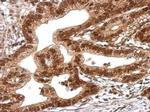 TRIM27 Antibody in Immunohistochemistry (Paraffin) (IHC (P))