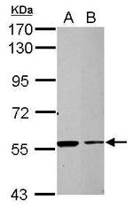 TRIM27 Antibody in Western Blot (WB)