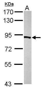 PFKP Antibody in Western Blot (WB)