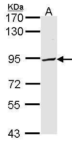 PFKP Antibody in Western Blot (WB)