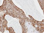 CKMT2 Antibody in Immunohistochemistry (Paraffin) (IHC (P))