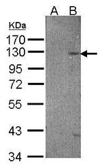 TYRO3 Antibody in Western Blot (WB)