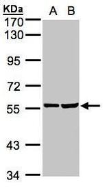 TAB1 Antibody in Western Blot (WB)