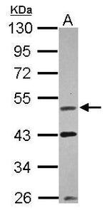 VRK1 Antibody in Western Blot (WB)