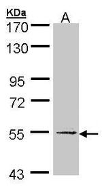 UGP2 Antibody in Western Blot (WB)