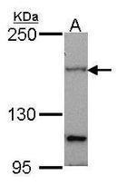 PTCH Antibody in Western Blot (WB)