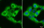 RBP1 Antibody in Immunocytochemistry (ICC/IF)