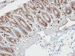 RBP1 Antibody in Immunohistochemistry (Paraffin) (IHC (P))