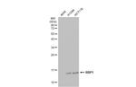 RBP1 Antibody in Western Blot (WB)