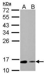 RBP1 Antibody in Western Blot (WB)