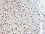 TAB182 Antibody in Immunohistochemistry (Paraffin) (IHC (P))