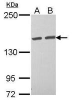 TAB182 Antibody in Western Blot (WB)