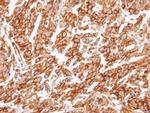 CYSLTR1 Antibody in Immunohistochemistry (Paraffin) (IHC (P))