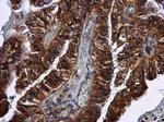 CXCR3 Antibody in Immunohistochemistry (Paraffin) (IHC (P))