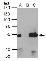 ESRRA Antibody in Immunoprecipitation (IP)