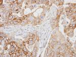 CD97 Antibody in Immunohistochemistry (Paraffin) (IHC (P))