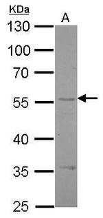 Endothelin B Receptor Antibody in Western Blot (WB)