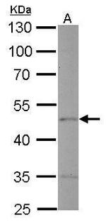 Endothelin B Receptor Antibody in Western Blot (WB)